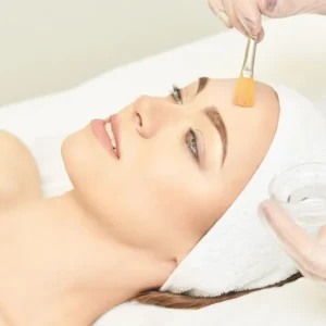 Chemical Peel