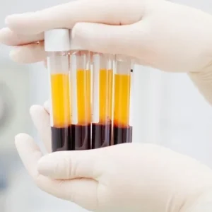 PRP (Platelet Rich Plasma)